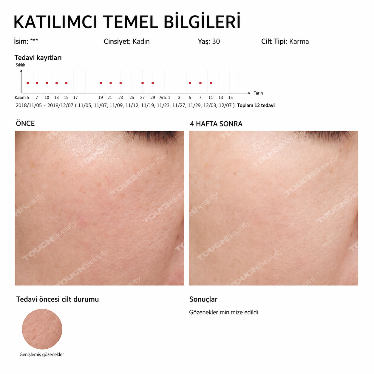 Akıllı Yüz ve Göz Masaj Cihazı Sıcak,Soğuk Terapi & Sonic Teknoloji ile Cilt Sıkılaştırma Cihazı
