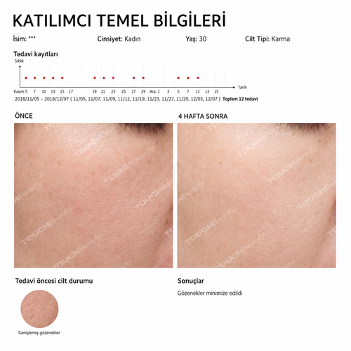 Akıllı Yüz ve Göz Masaj Cihazı Sıcak,Soğuk Terapi & Sonic Teknoloji ile Cilt Sıkılaştırma Cihazı