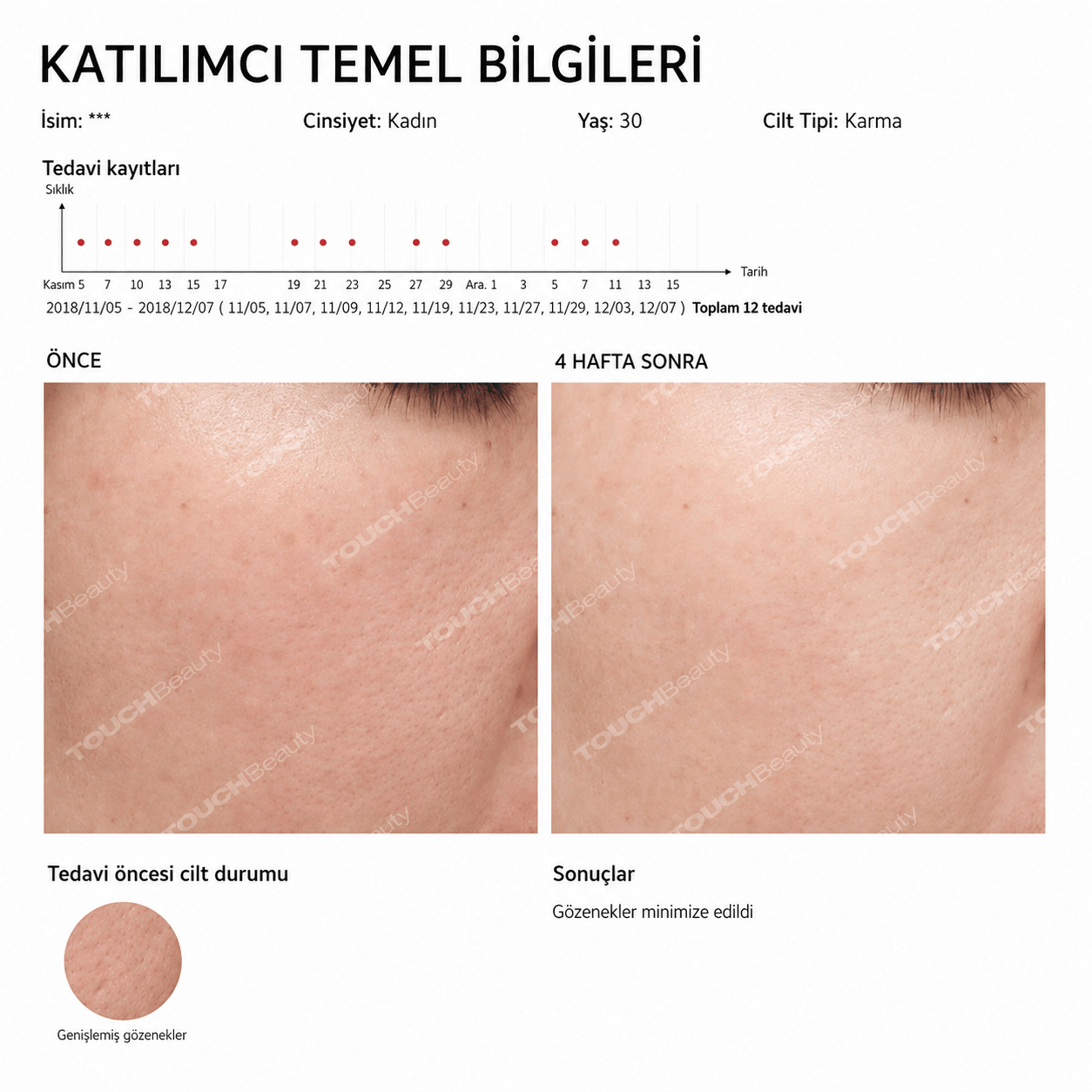 Akıllı Yüz ve Göz Masaj Cihazı Sıcak,Soğuk Terapi & Sonic Teknoloji ile Cilt Sıkılaştırma - TouchBeauty