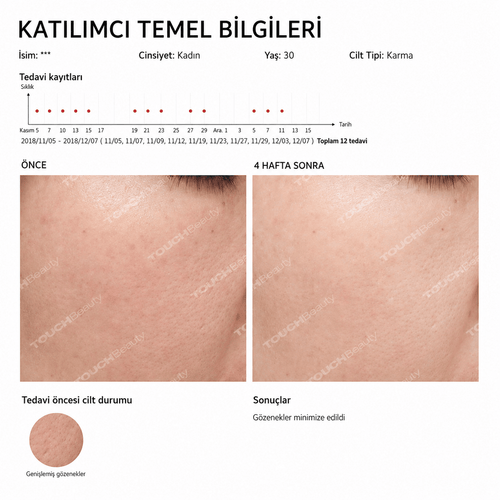 Akıllı Yüz ve Göz Masaj Cihazı Sıcak,Soğuk Terapi & Sonic Teknoloji ile Cilt Sıkılaştırma - TouchBeauty